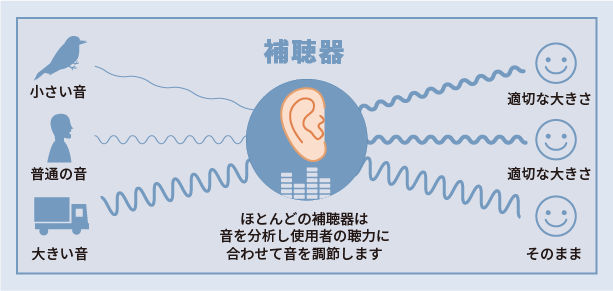ほとんどの補聴器は音を分析し使用者の聴力に合わせて音を調節します