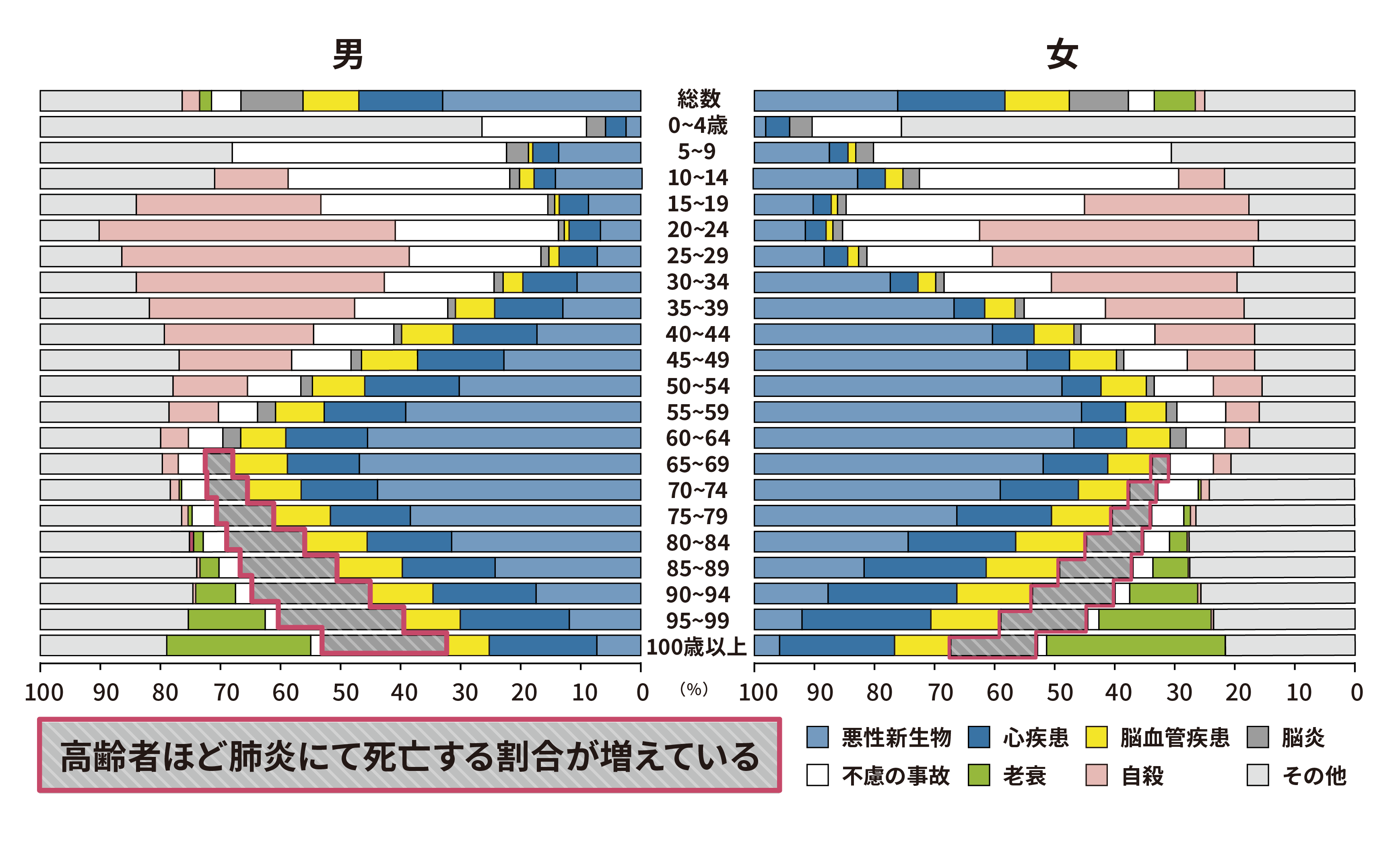 死因としての肺炎（年代別）