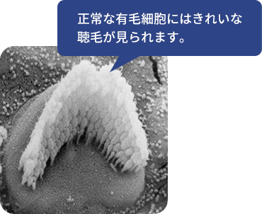 正常な有毛細胞にはきれいな聴毛が見られます。