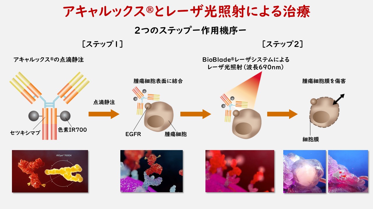 頭頸部がんができる主な部位