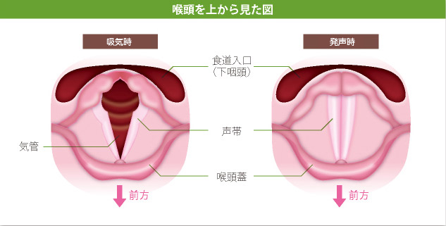 声帯 に 痰 が 絡む